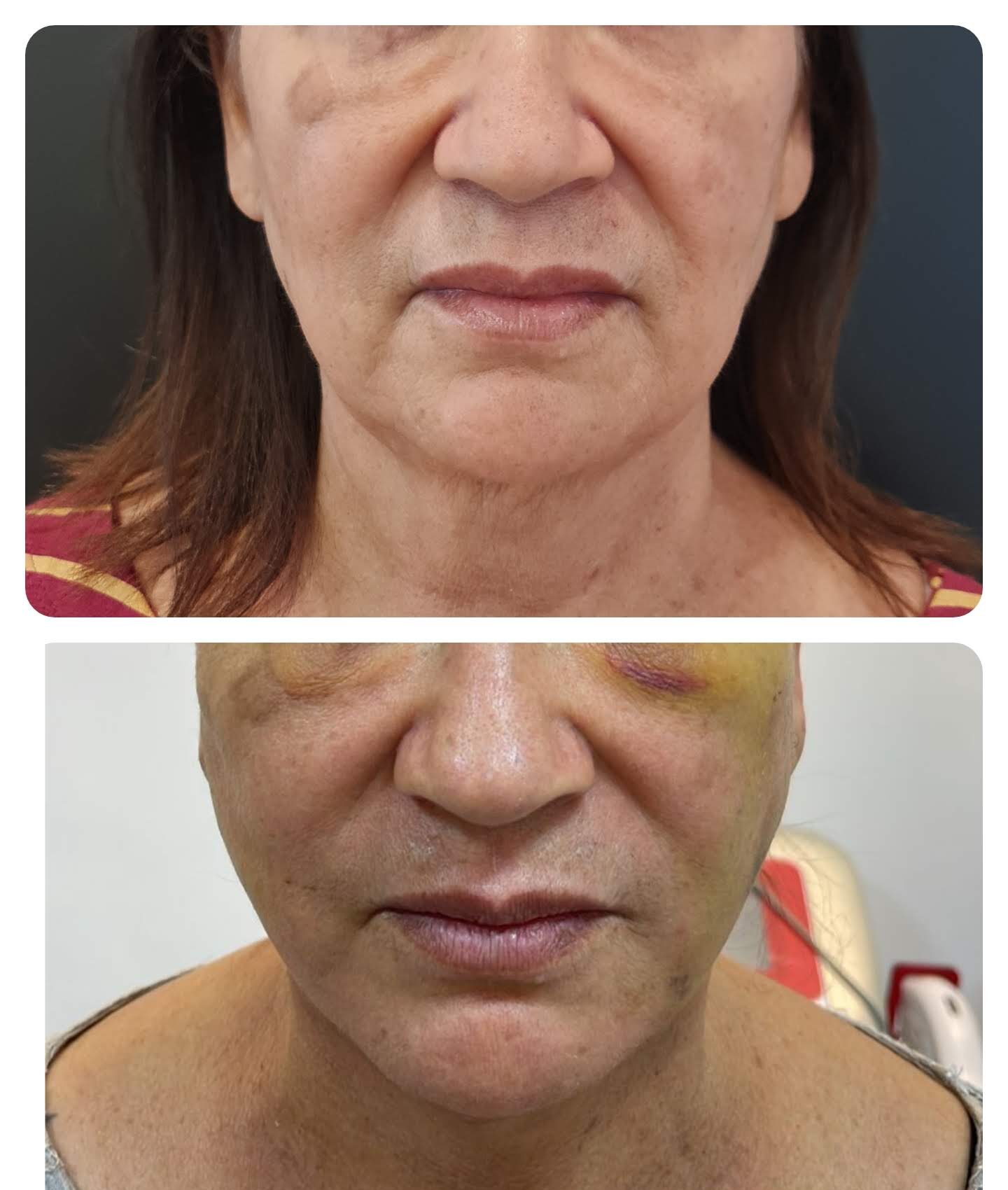 Collage_2025-08-20_23_14_51