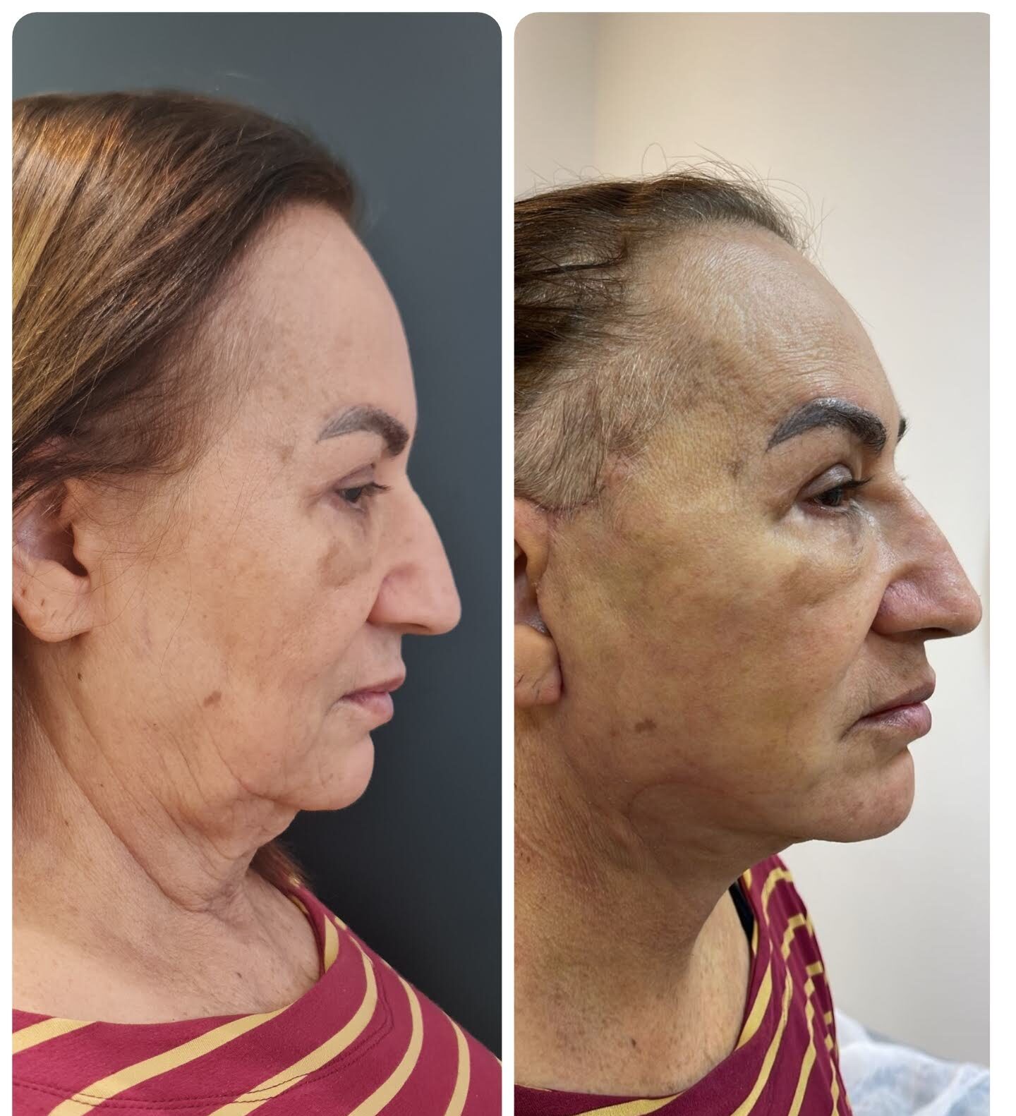 Collage_2025-08-25_11_06_22